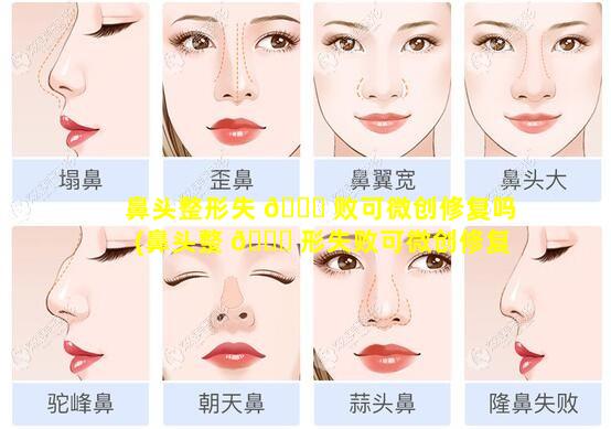 鼻头整形失 🐝 败可微创修复吗(鼻头整 🐒 形失败可微创修复吗多少钱)